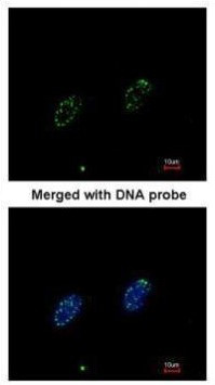 RPA70 Antibody in Immunocytochemistry (ICC/IF)