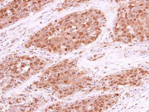 RPA70 Antibody in Immunohistochemistry (Paraffin) (IHC (P))