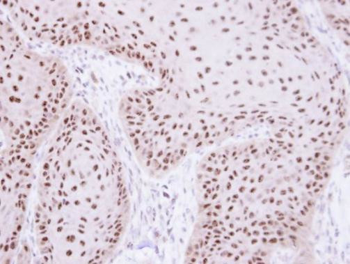 RPA70 Antibody in Immunohistochemistry (Paraffin) (IHC (P))