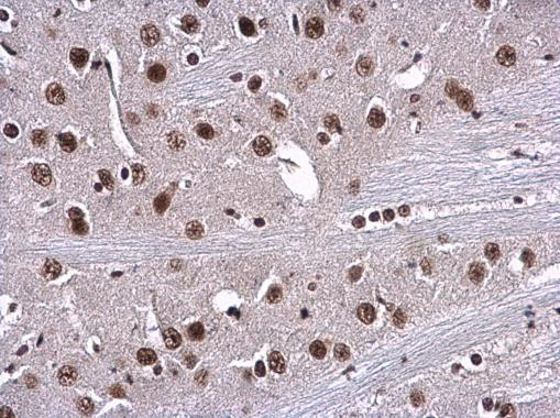 RPA70 Antibody in Immunohistochemistry (Paraffin) (IHC (P))