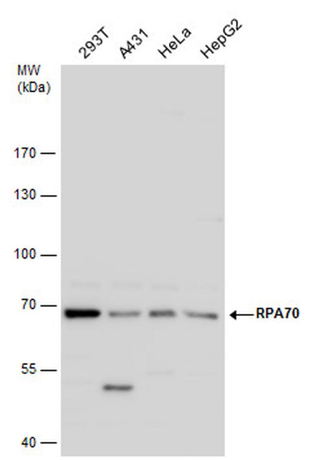 RPA70 Antibody in Western Blot (WB)