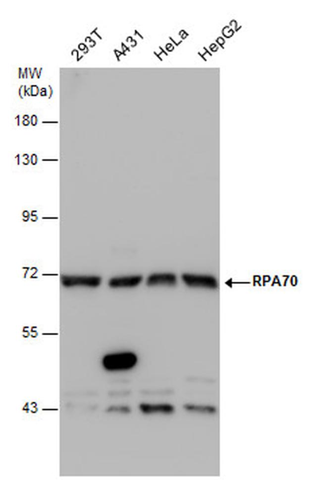 RPA70 Antibody in Western Blot (WB)