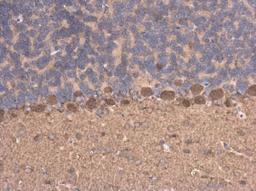 Njmu-R1 Antibody in Immunohistochemistry (Paraffin) (IHC (P))