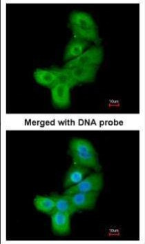 LIMK2 Antibody in Immunocytochemistry (ICC/IF)