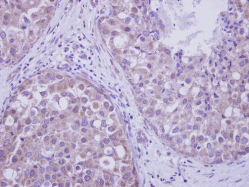 LIMK2 Antibody in Immunohistochemistry (Paraffin) (IHC (P))