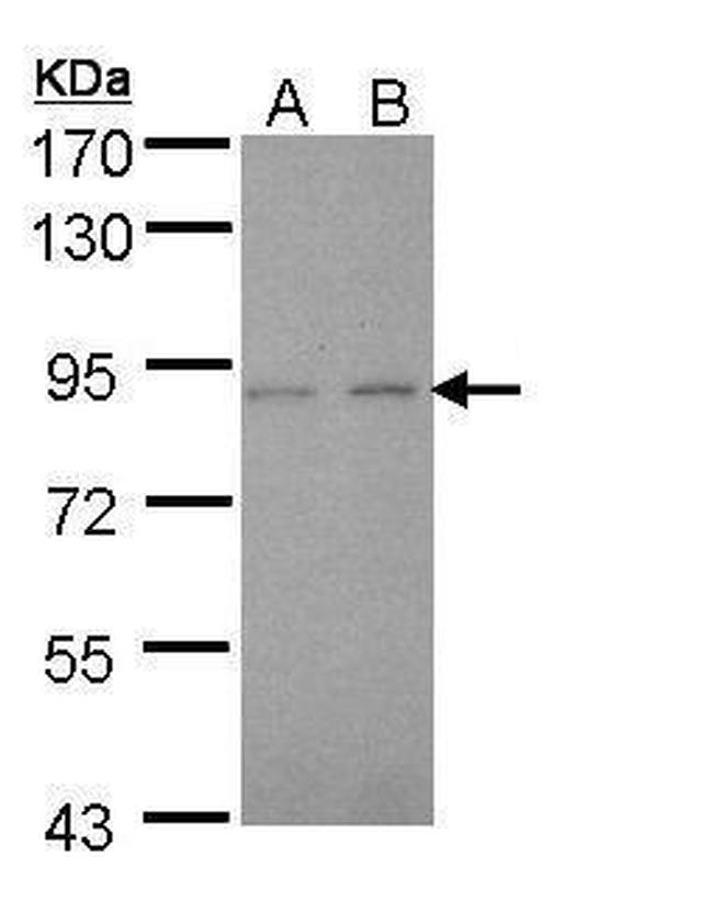 LIMK2 Antibody in Western Blot (WB)