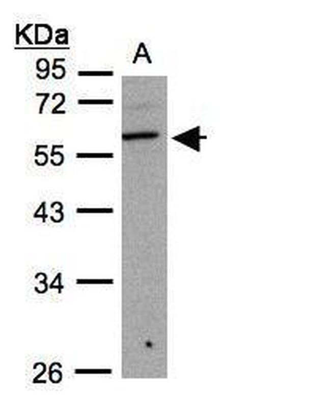 B3GNT3 Antibody in Western Blot (WB)