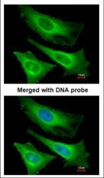 TNNI3K Antibody in Immunocytochemistry (ICC/IF)