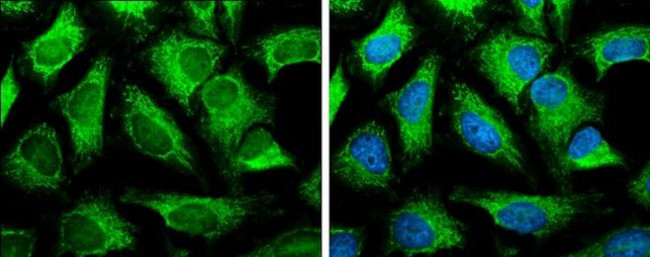 SLC25A13 Antibody in Immunocytochemistry (ICC/IF)