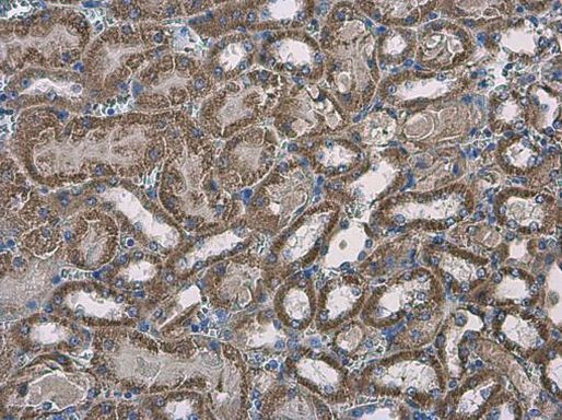 SLC25A13 Antibody in Immunohistochemistry (Paraffin) (IHC (P))