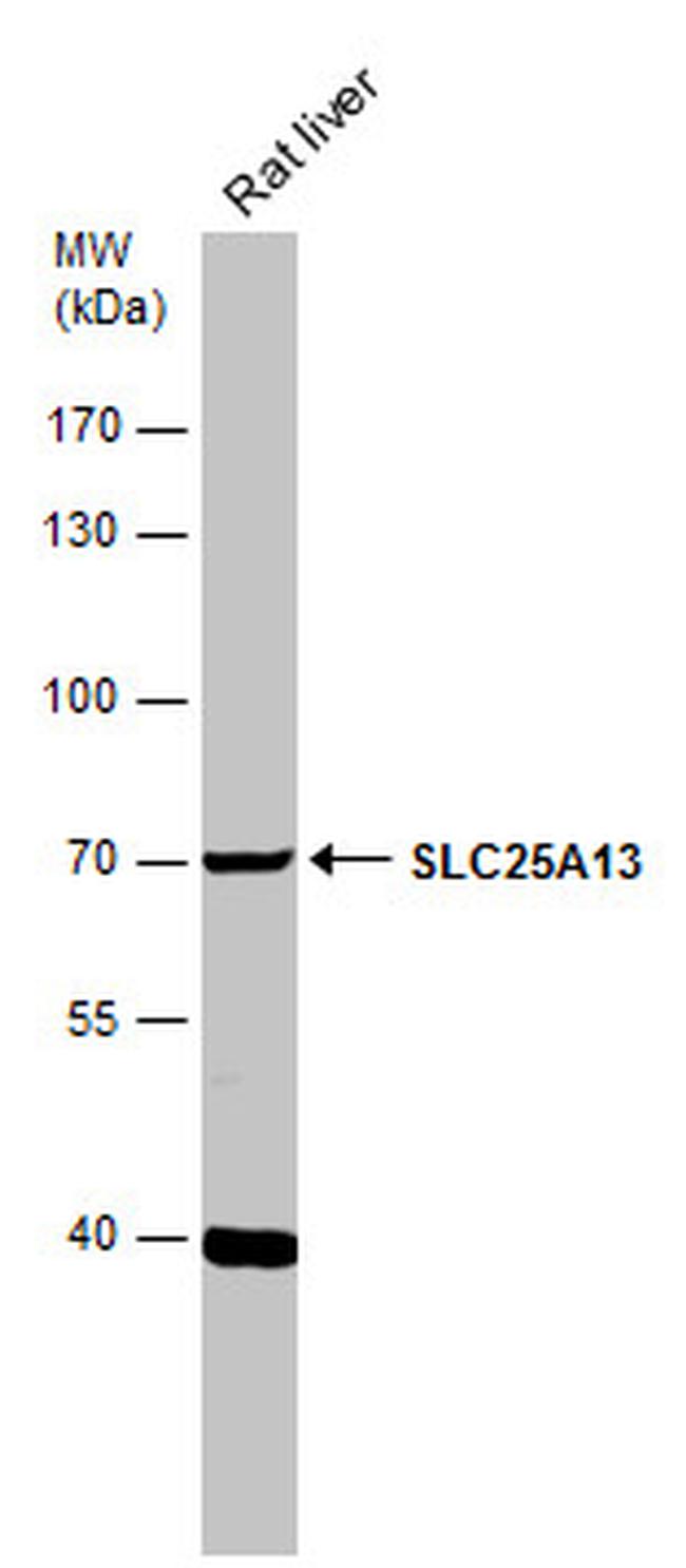 SLC25A13 Antibody in Western Blot (WB)