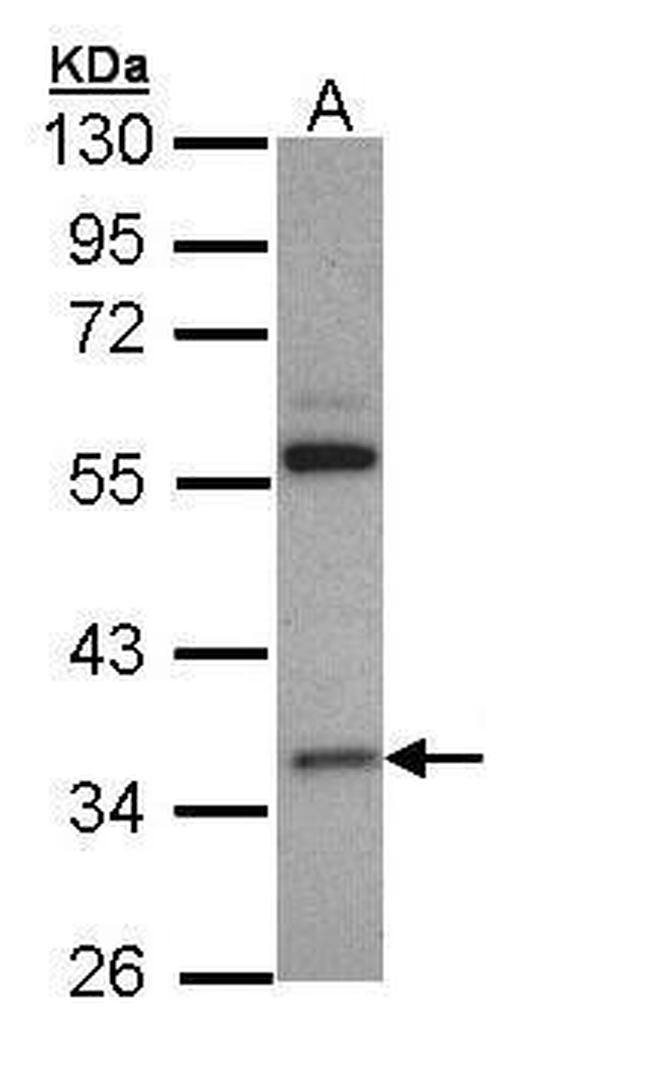 HMGCL Antibody in Western Blot (WB)