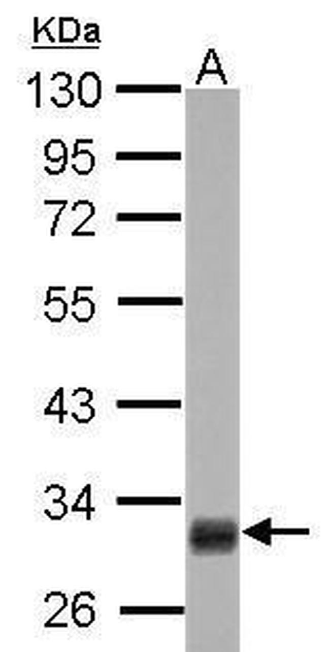 HMGCL Antibody in Western Blot (WB)