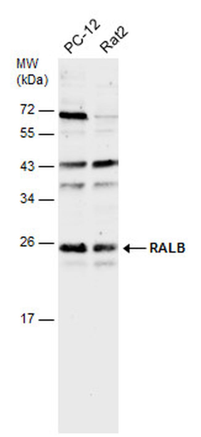 RALB Antibody in Western Blot (WB)