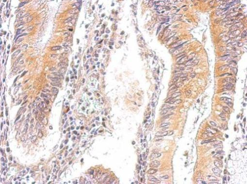 AMPK gamma-2 Antibody in Immunohistochemistry (Paraffin) (IHC (P))