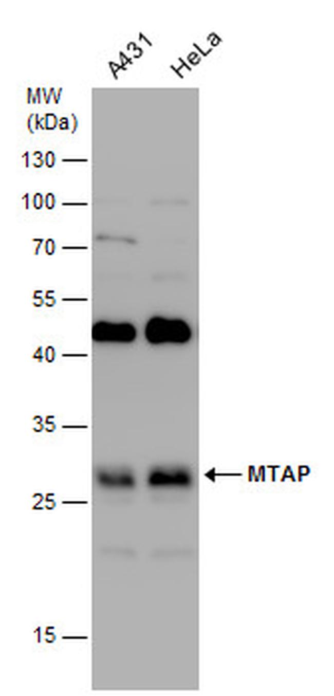 MTAP Antibody in Western Blot (WB)