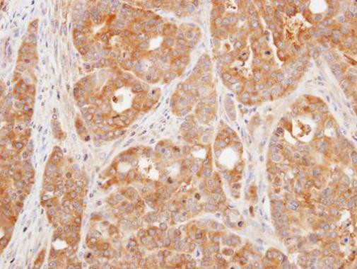 DUSP3 Antibody in Immunohistochemistry (Paraffin) (IHC (P))