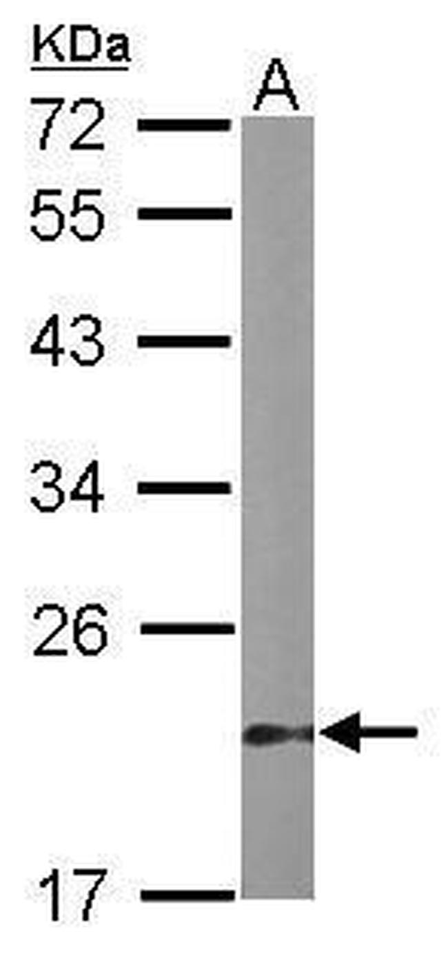 DUSP3 Antibody in Western Blot (WB)