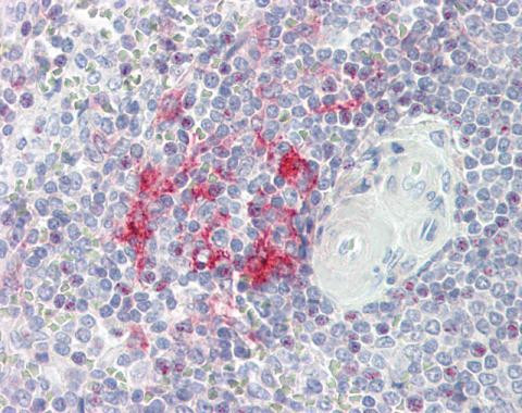 LITAF Antibody in Immunohistochemistry (Paraffin) (IHC (P))