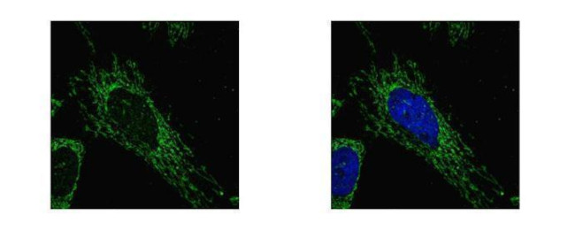 SUCLG1 Antibody in Immunocytochemistry (ICC/IF)