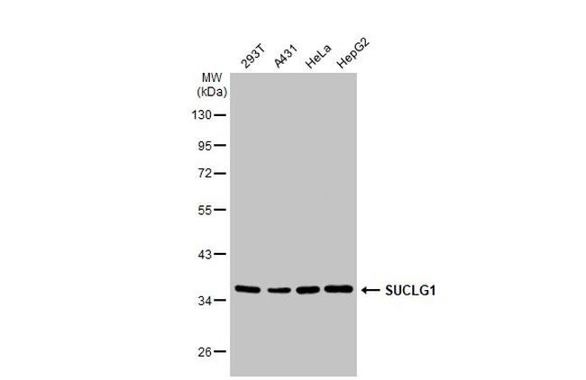 SUCLG1 Antibody in Western Blot (WB)