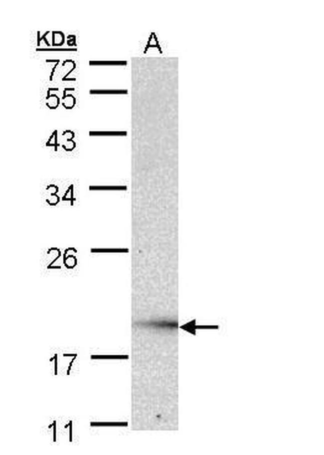 UBE2G2 Antibody in Western Blot (WB)