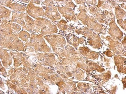 GSTT1 Antibody in Immunohistochemistry (Paraffin) (IHC (P))