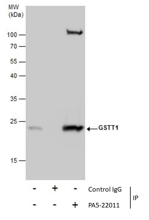 GSTT1 Antibody in Immunoprecipitation (IP)