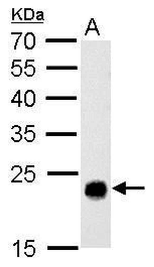 GSTT1 Antibody in Western Blot (WB)