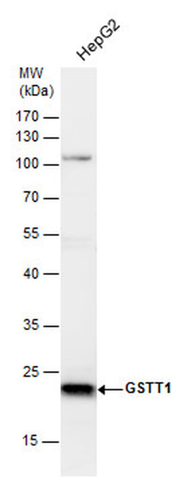 GSTT1 Antibody in Western Blot (WB)