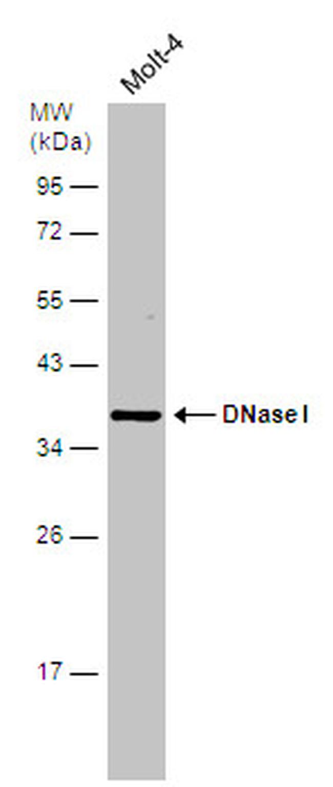 DNase I Antibody in Western Blot (WB)