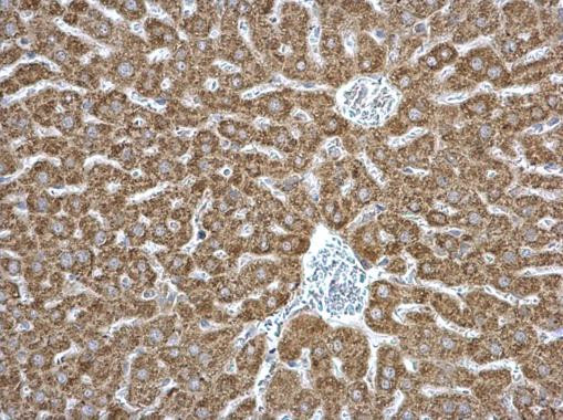 EPHX1 Antibody in Immunohistochemistry (Paraffin) (IHC (P))