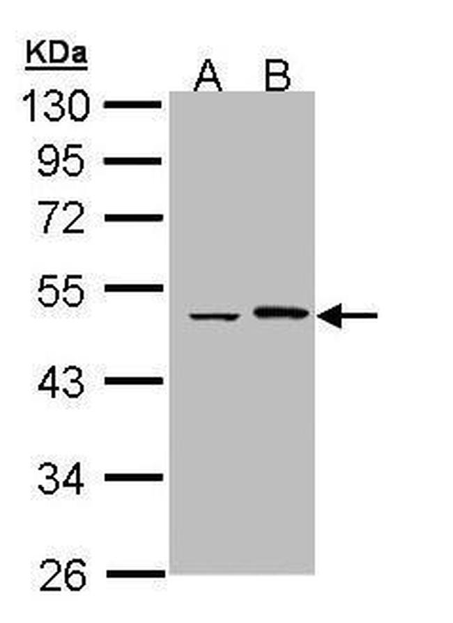 EPHX1 Antibody in Western Blot (WB)