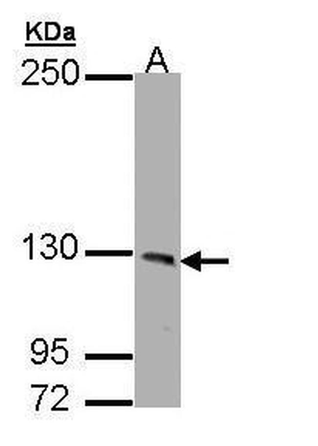 PHKA1 Antibody in Western Blot (WB)