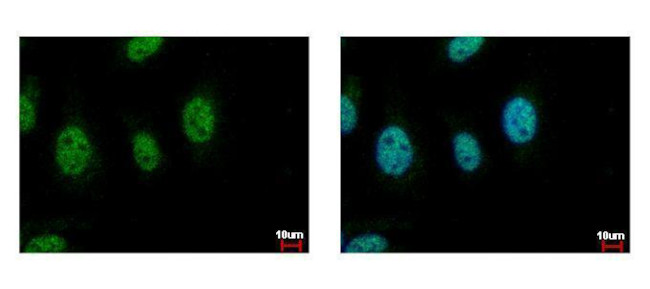 Cdc45L Antibody in Immunocytochemistry (ICC/IF)