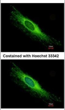 PEX26 Antibody in Immunocytochemistry (ICC/IF)