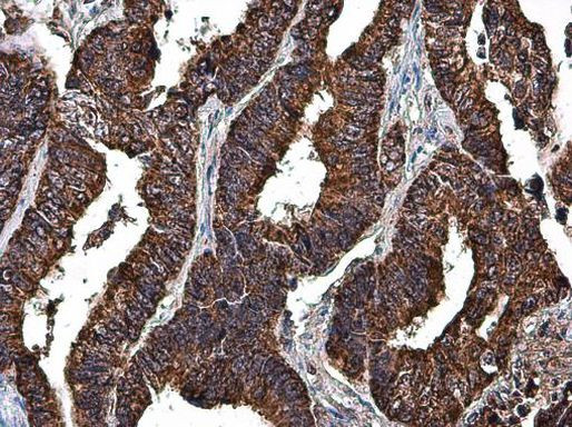 LRP130 Antibody in Immunohistochemistry (Paraffin) (IHC (P))