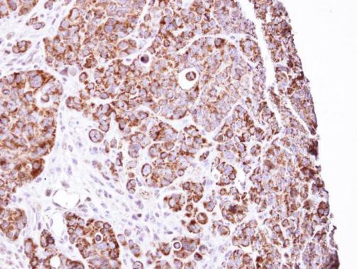 LRP130 Antibody in Immunohistochemistry (Paraffin) (IHC (P))