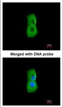 PSMC3 Antibody in Immunocytochemistry (ICC/IF)