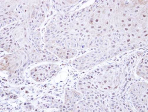 PSMC3 Antibody in Immunohistochemistry (Paraffin) (IHC (P))