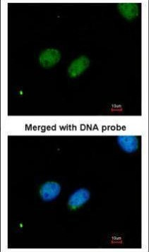 XRCC4 Antibody in Immunocytochemistry (ICC/IF)