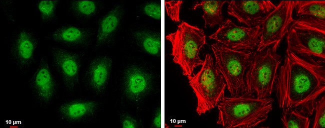 RAG2 Antibody in Immunocytochemistry (ICC/IF)