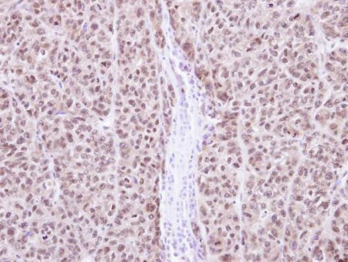 RAG2 Antibody in Immunohistochemistry (Paraffin) (IHC (P))