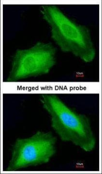 DDX3Y Antibody in Immunocytochemistry (ICC/IF)