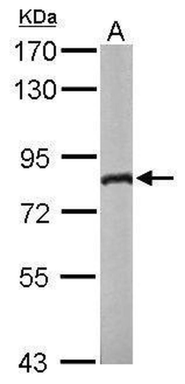 DDX3Y Antibody in Western Blot (WB)