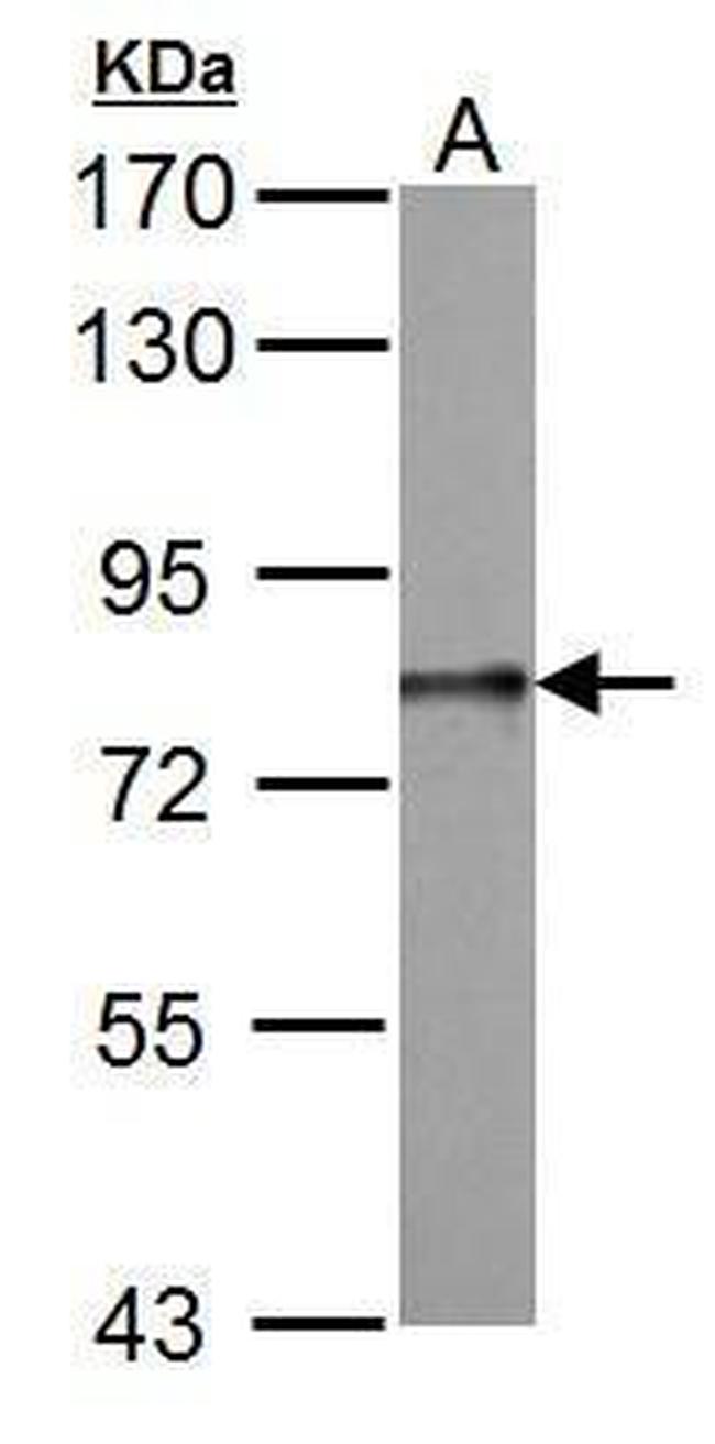 DDX3Y Antibody in Western Blot (WB)