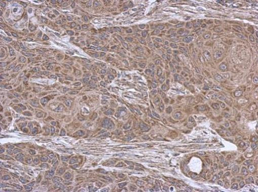 SUCLA2 Antibody in Immunohistochemistry (Paraffin) (IHC (P))