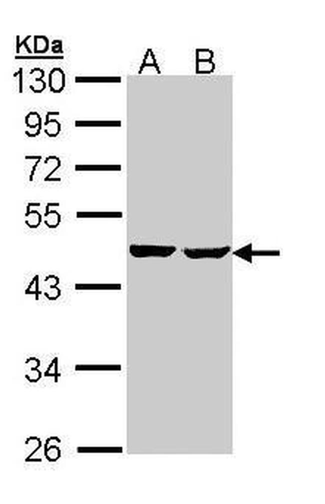 SUCLA2 Antibody in Western Blot (WB)