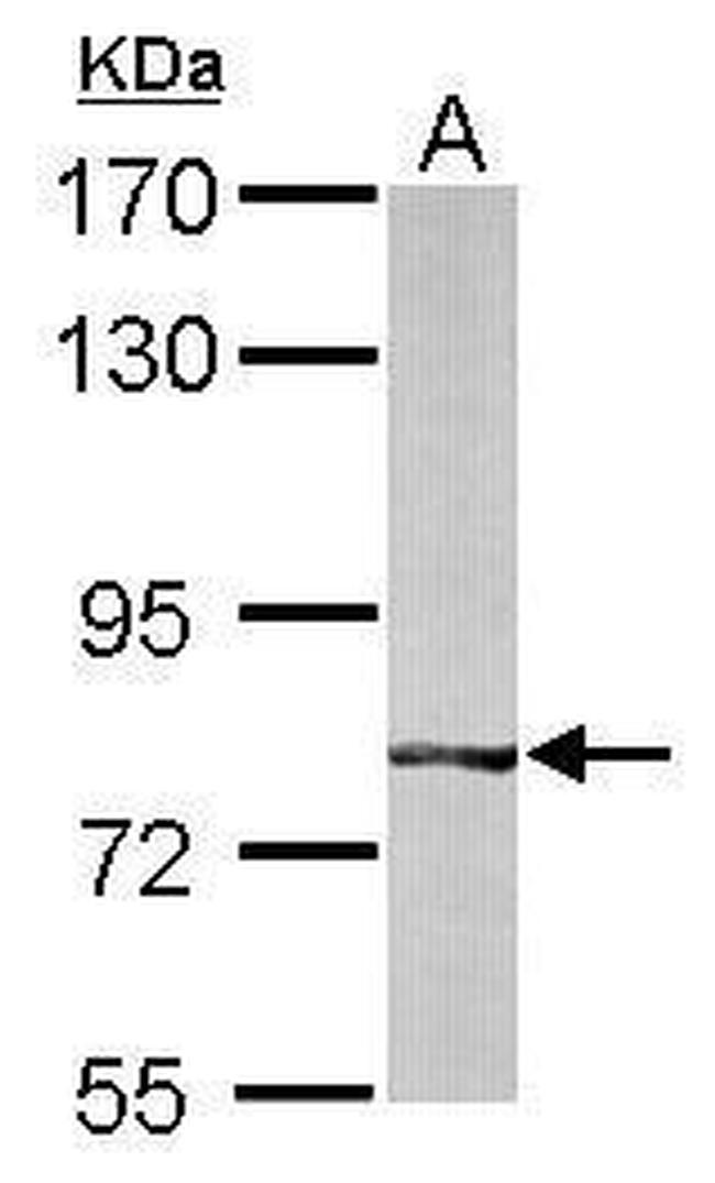 BBS7 Antibody in Western Blot (WB)