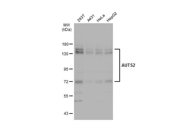 AUTS2 Antibody in Western Blot (WB)